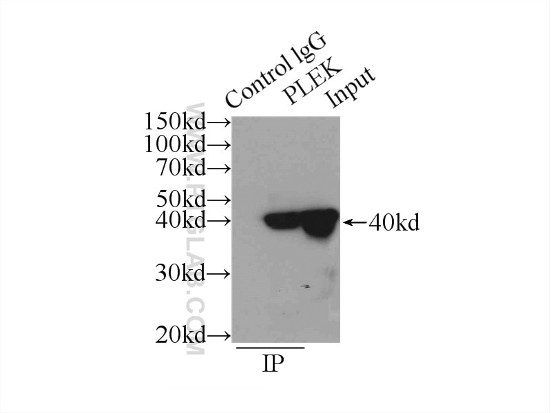Immunoprecipitation (IP) experiment of U-937 cells using PLEK Polyclonal antibody (12506-1-AP)