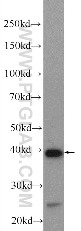 WB analysis of rat spleen using 12506-1-AP