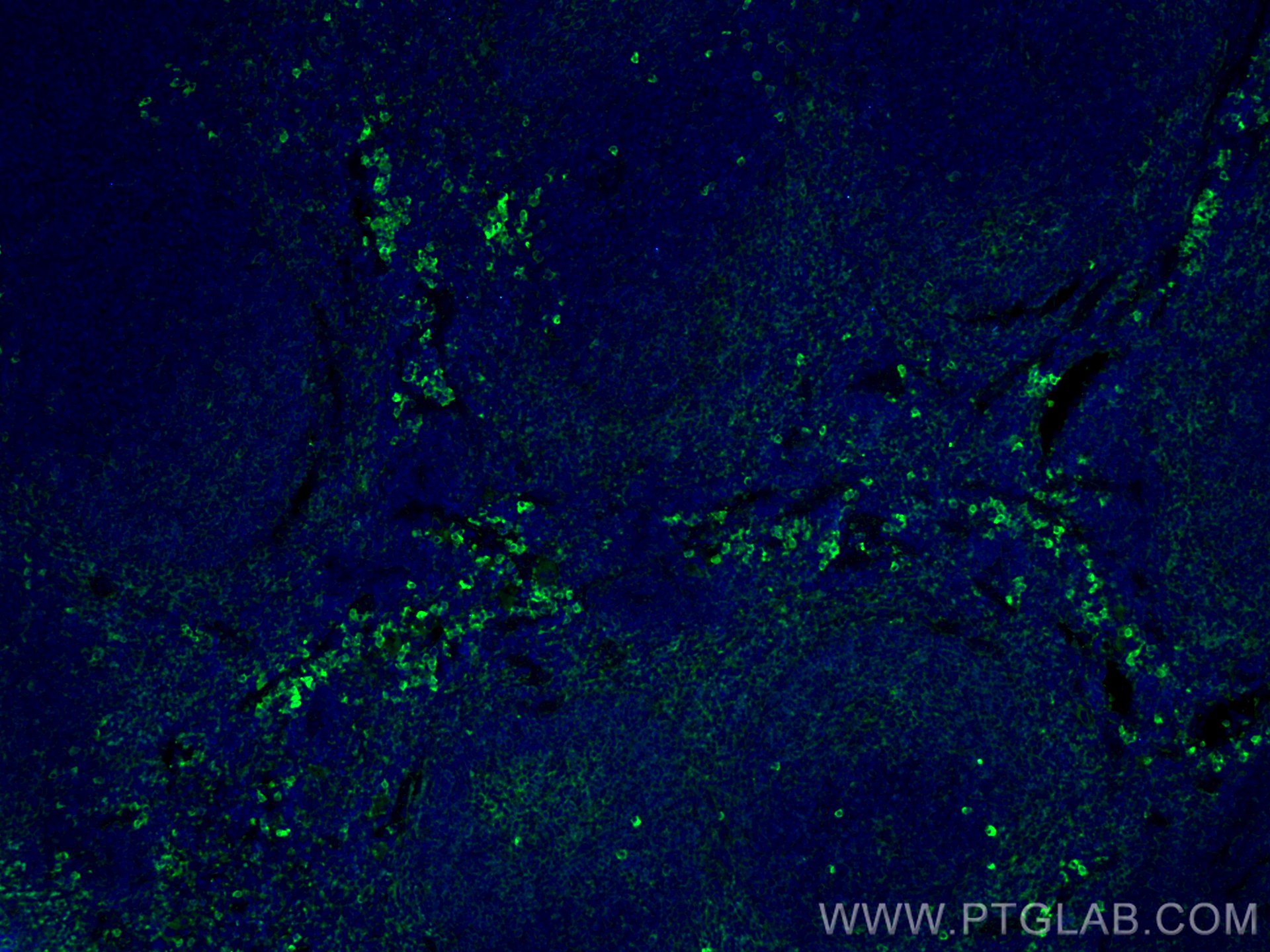 Immunofluorescence (IF) / fluorescent staining of mouse spleen tissue using PLEK Monoclonal antibody (66431-1-Ig)