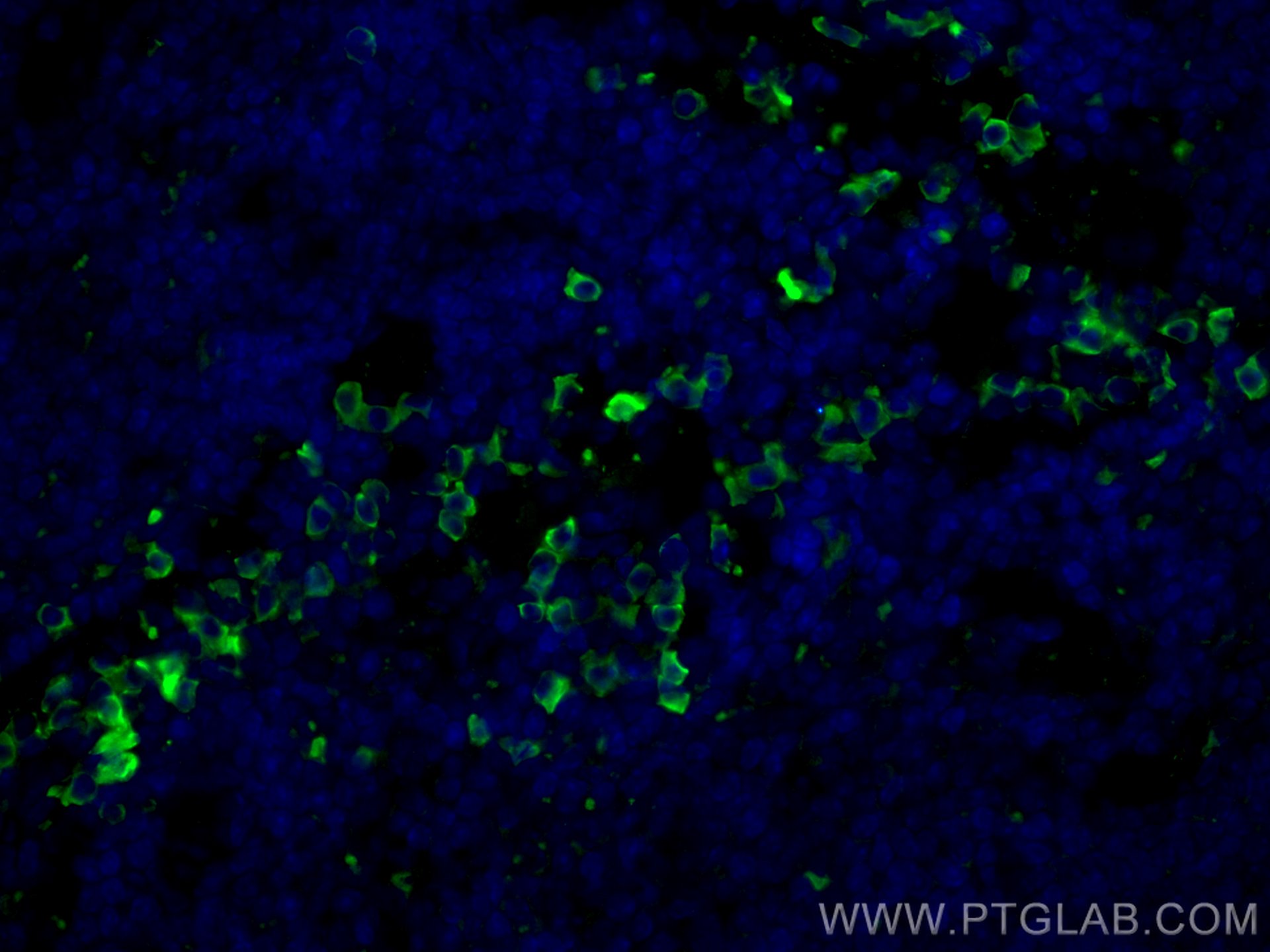 Immunofluorescence (IF) / fluorescent staining of mouse spleen tissue using PLEK Monoclonal antibody (66431-1-Ig)