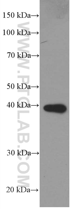 Western Blot (WB) analysis of pig spleen tissue using PLEK Monoclonal antibody (66431-1-Ig)