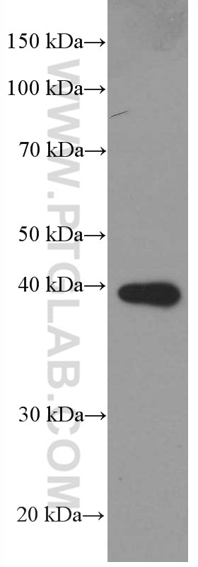 WB analysis of pig spleen using 66431-1-Ig