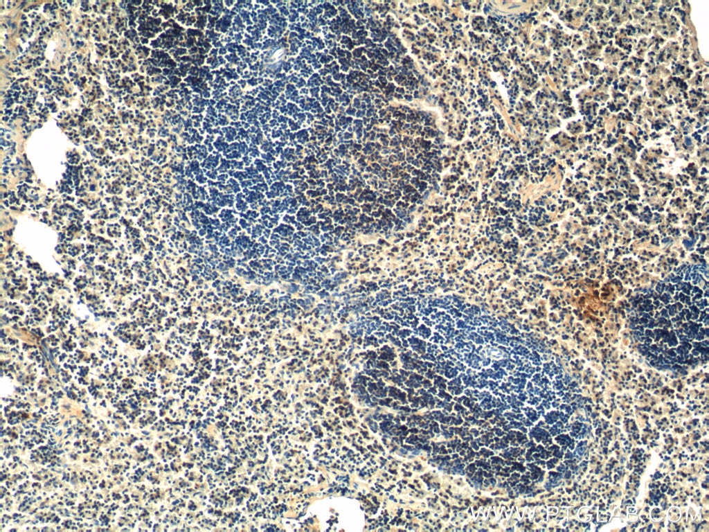 Immunohistochemistry (IHC) staining of mouse spleen tissue using PLEK2 Polyclonal antibody (11685-1-AP)