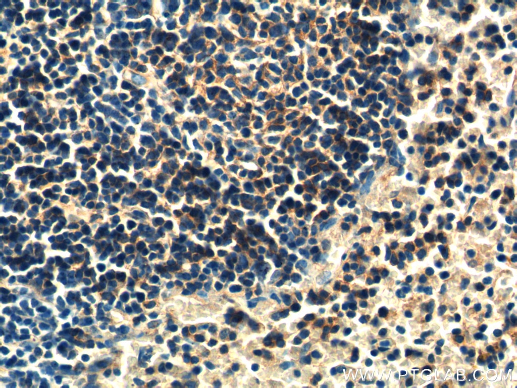 Immunohistochemistry (IHC) staining of mouse spleen tissue using PLEK2 Polyclonal antibody (11685-1-AP)