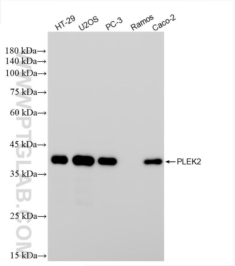 Western Blot (WB) analysis of various lysates using PLEK2 Recombinant antibody (85619-4-RR)