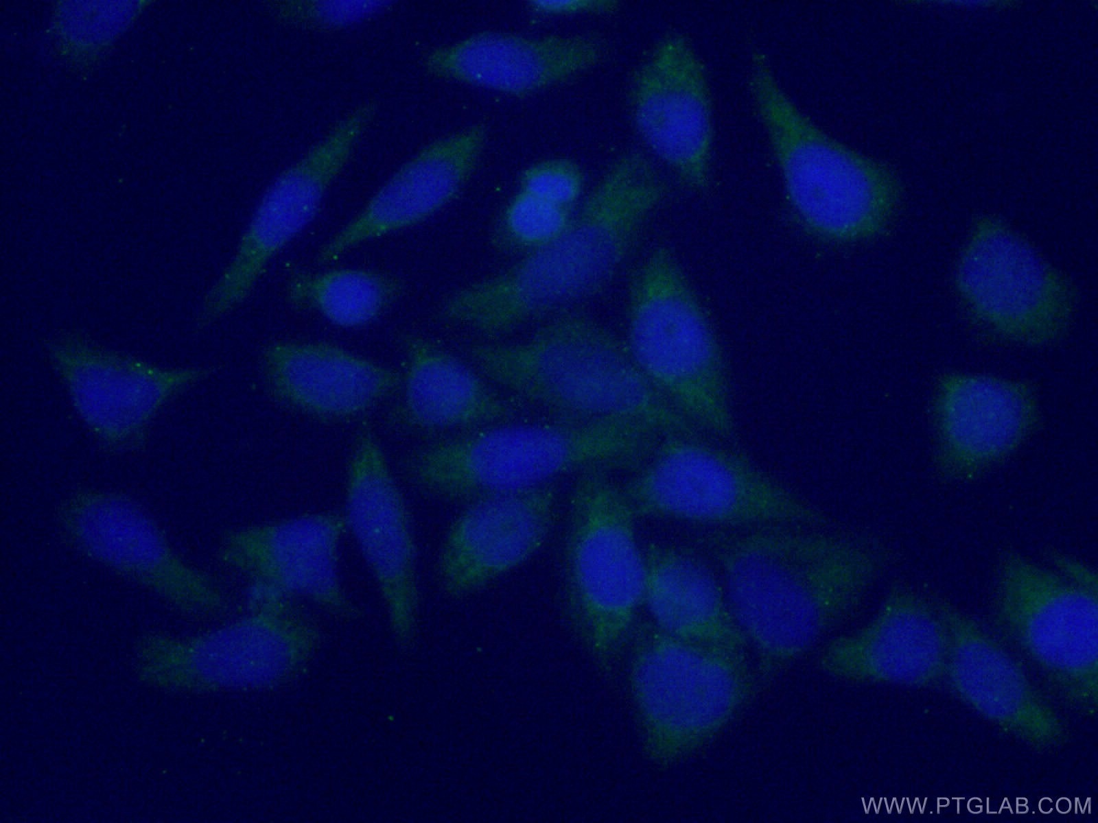 Immunofluorescence (IF) / fluorescent staining of HeLa cells using PLEKHA1 Polyclonal antibody (10238-1-AP)