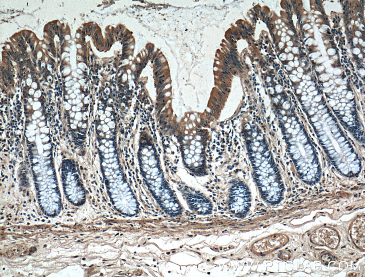 Immunohistochemistry (IHC) staining of human colon tissue using PLEKHA1 Polyclonal antibody (10238-1-AP)