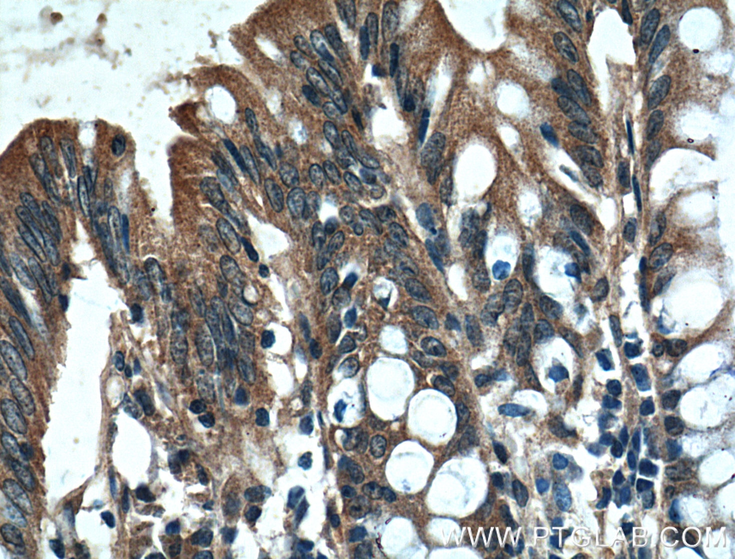Immunohistochemistry (IHC) staining of human colon tissue using PLEKHA1 Polyclonal antibody (10238-1-AP)