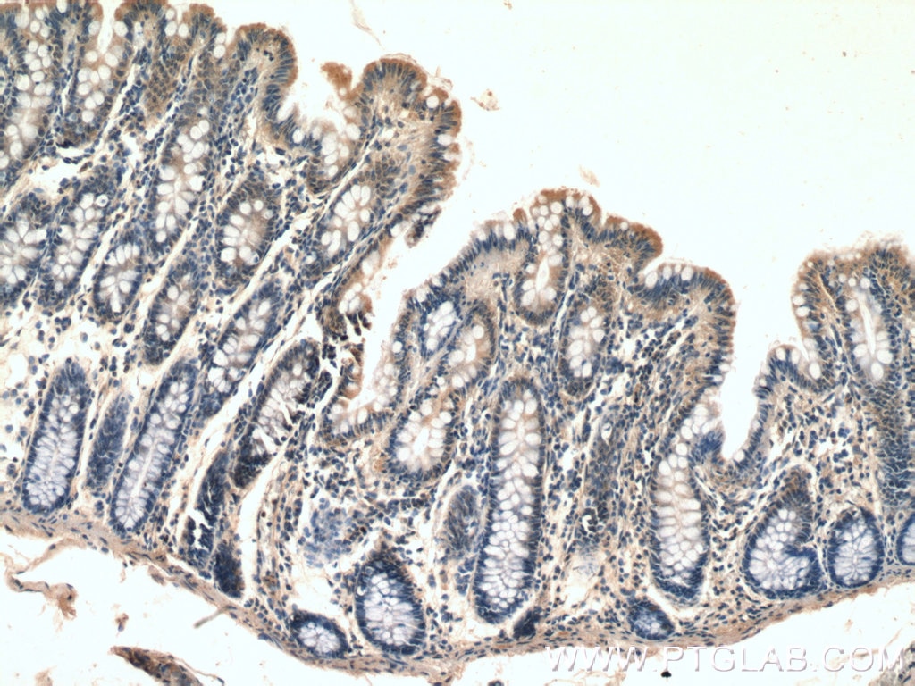 Immunohistochemistry (IHC) staining of human colon tissue using PLEKHA1 Polyclonal antibody (26830-1-AP)