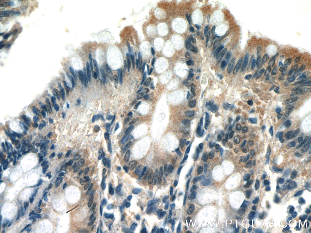 Immunohistochemistry (IHC) staining of human colon tissue using PLEKHA1 Polyclonal antibody (26830-1-AP)