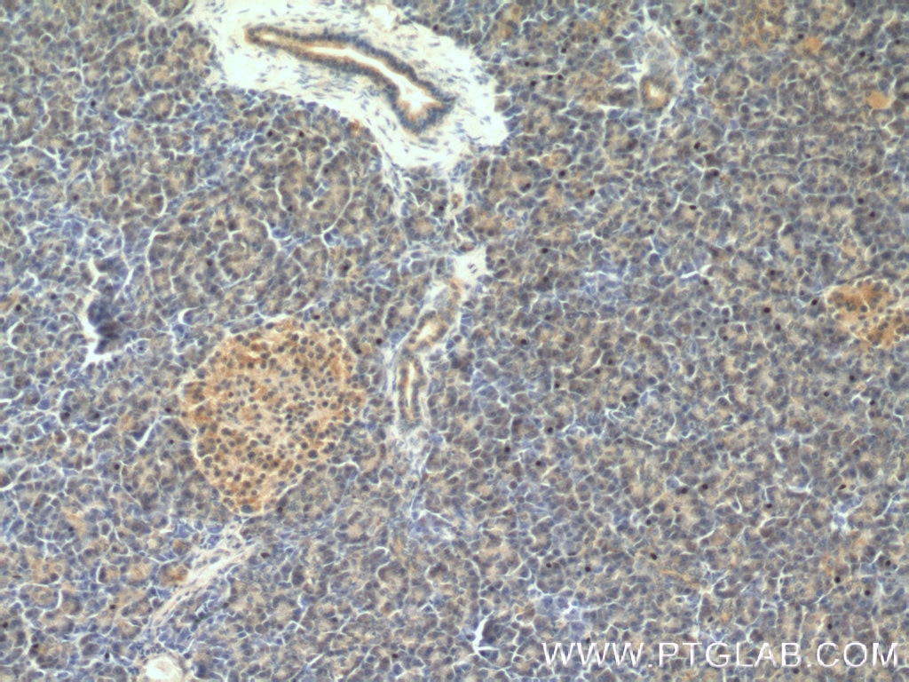 Immunohistochemistry (IHC) staining of human pancreas tissue using PLEKHA1 Polyclonal antibody (26830-1-AP)