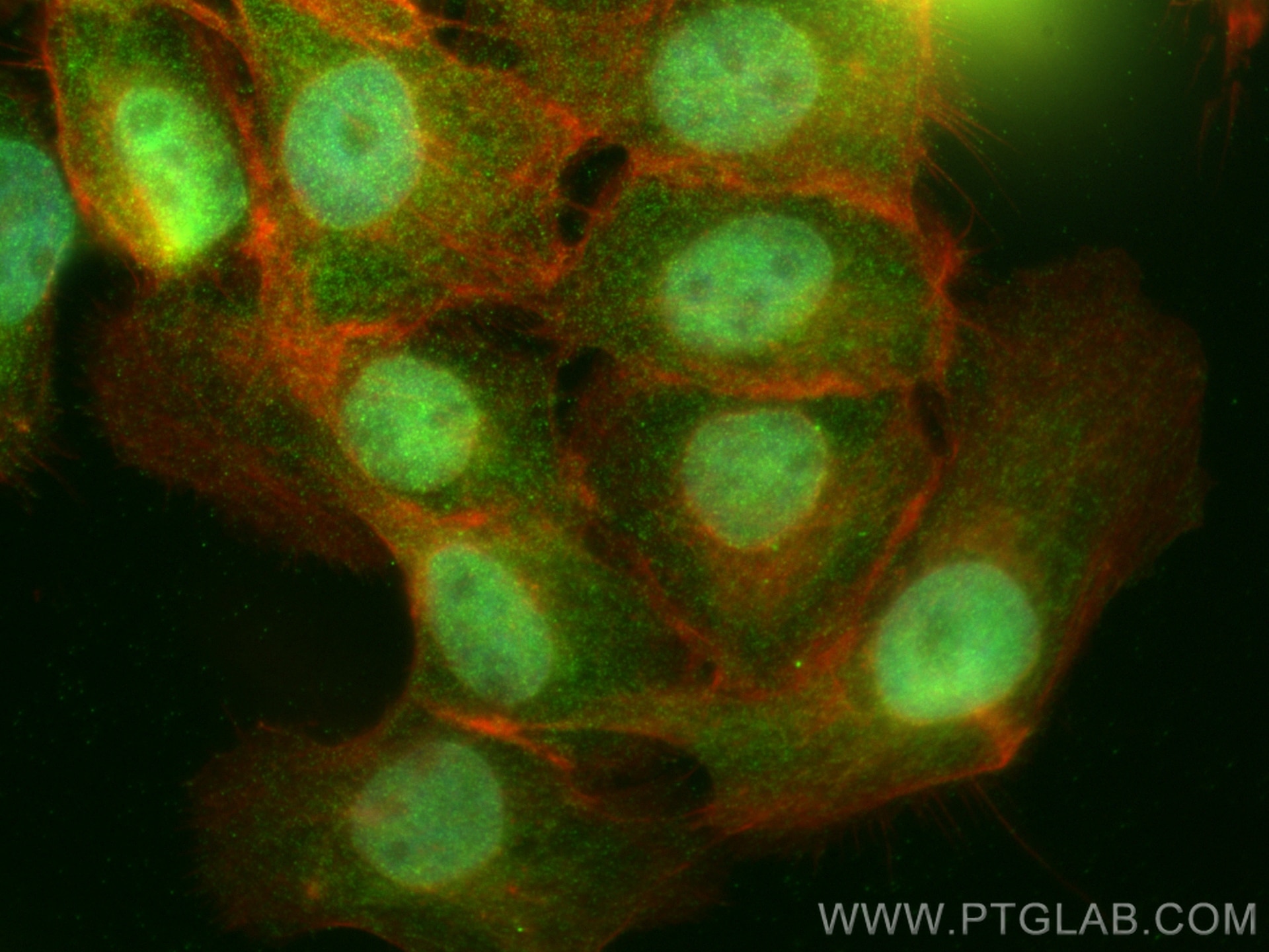 Immunofluorescence (IF) / fluorescent staining of A431 cells using PLEKHA2 Polyclonal antibody (32169-1-AP)