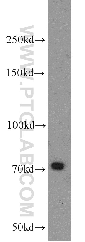 Western Blot (WB) analysis of mouse kidney tissue using PLEKHA5 Polyclonal antibody (13045-1-AP)