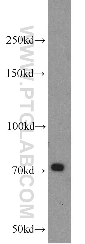 WB analysis of mouse kidney using 13045-1-AP