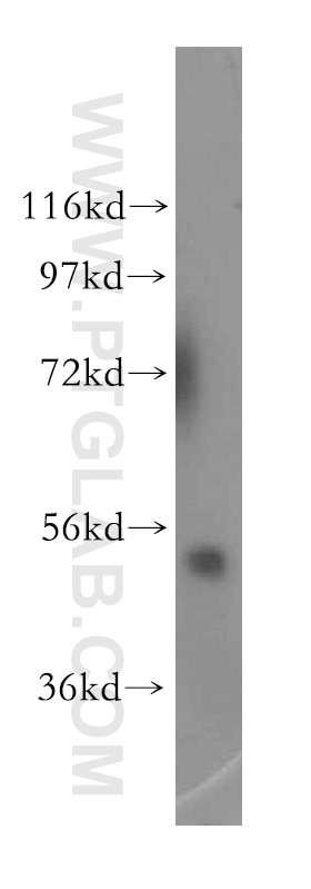 Western Blot (WB) analysis of mouse brain tissue using FAPP2 Polyclonal antibody (15410-1-AP)