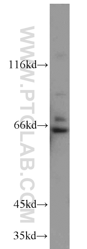 Western Blot (WB) analysis of HeLa cells using PLEKHA9 Polyclonal antibody (17568-1-AP)
