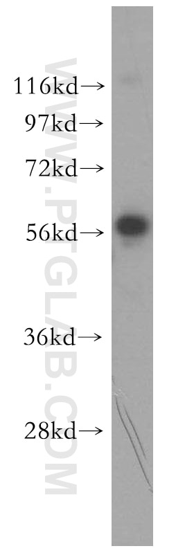 Western Blot (WB) analysis of HeLa cells using PLEKHA9 Polyclonal antibody (17568-1-AP)