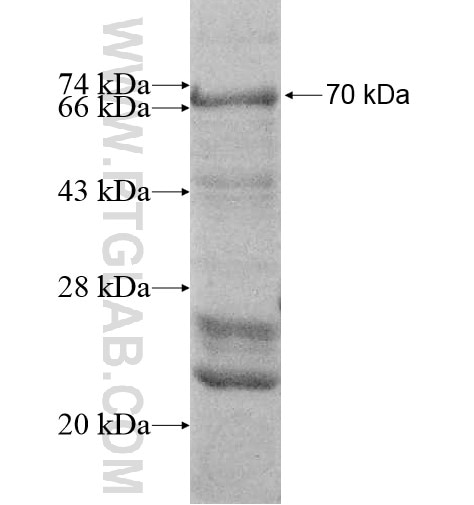 PLEKHA9 fusion protein Ag11772 SDS-PAGE