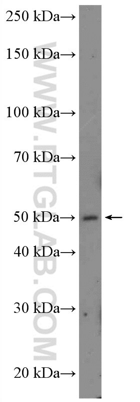 WB analysis of SH-SY5Y using 10512-1-AP