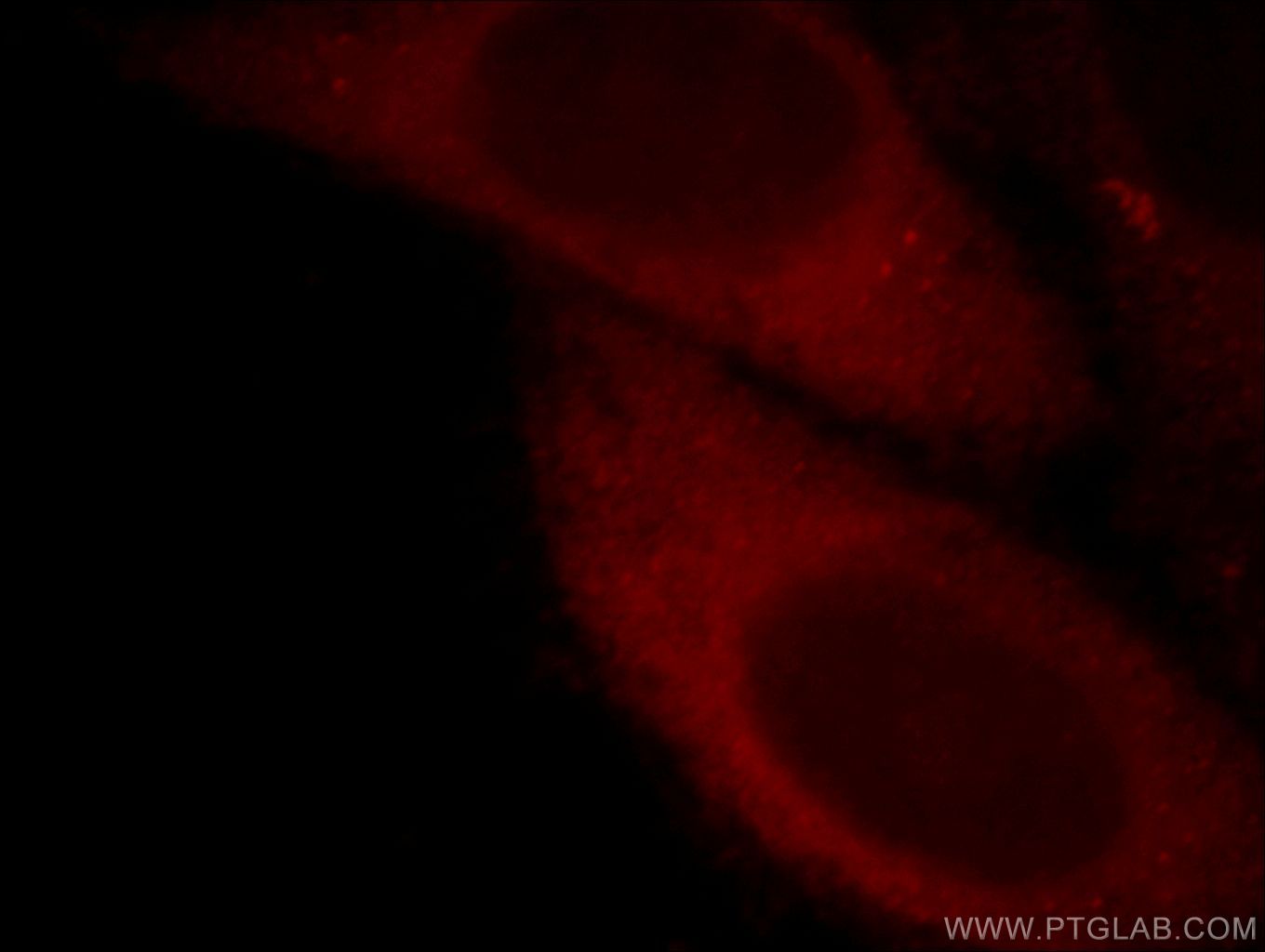 Immunofluorescence (IF) / fluorescent staining of HepG2 cells using PLEKHF1 Polyclonal antibody (20389-1-AP)