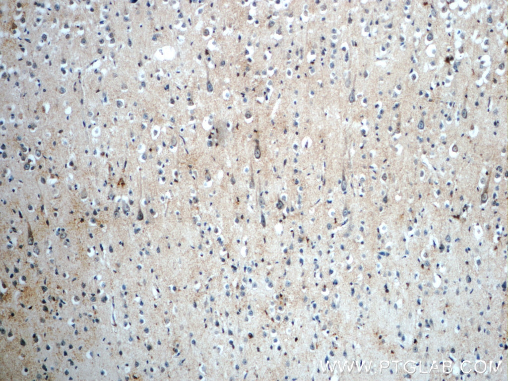 Immunohistochemistry (IHC) staining of human brain tissue using PLEKHF1 Polyclonal antibody (20389-1-AP)