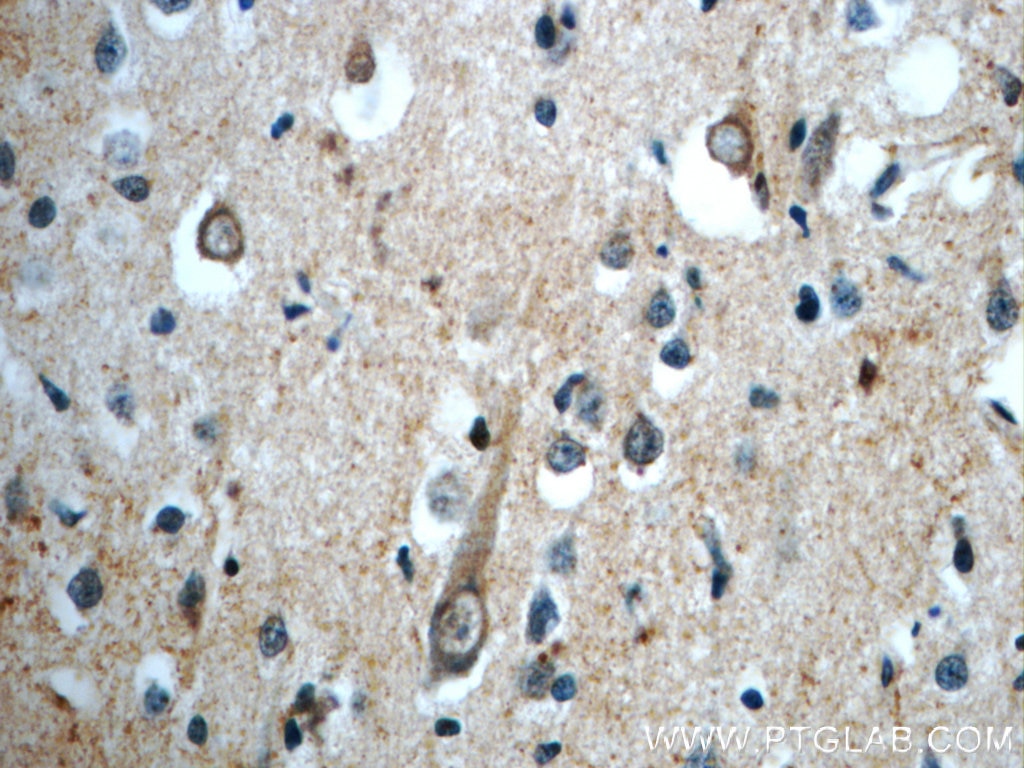 Immunohistochemistry (IHC) staining of human brain tissue using PLEKHF1 Polyclonal antibody (20389-1-AP)