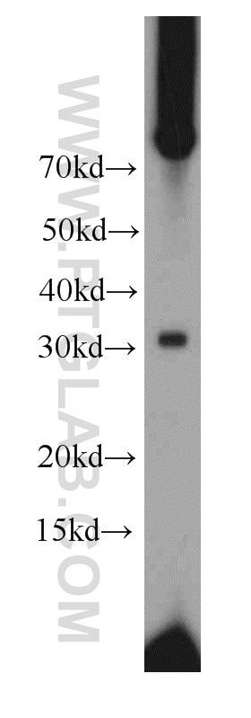 Western Blot (WB) analysis of mouse spleen tissue using PLEKHF1 Polyclonal antibody (20389-1-AP)