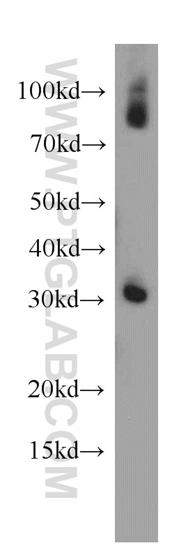 Western Blot (WB) analysis of human skeletal muscle tissue using PLEKHF1 Polyclonal antibody (20389-1-AP)