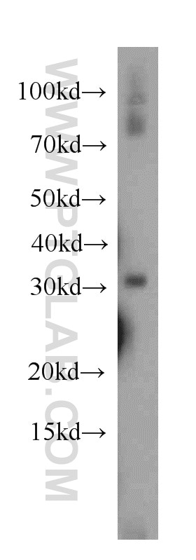 Western Blot (WB) analysis of human kidney tissue using PLEKHF1 Polyclonal antibody (20389-1-AP)