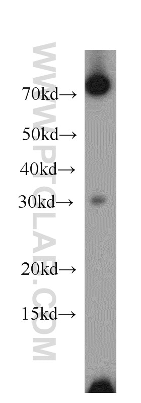 Western Blot (WB) analysis of mouse lung tissue using PLEKHF1 Polyclonal antibody (20389-1-AP)