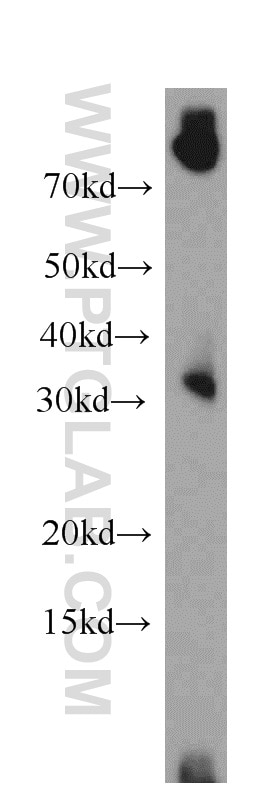 Western Blot (WB) analysis of mouse thymus tissue using PLEKHF1 Polyclonal antibody (20389-1-AP)