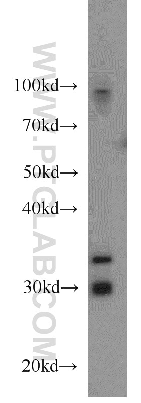 Western Blot (WB) analysis of mouse skeletal muscle tissue using PLEKHF1 Polyclonal antibody (20389-1-AP)