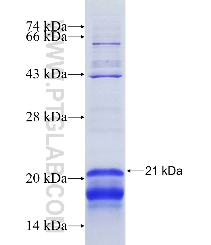 PLEKHF1 fusion protein Ag16949 SDS-PAGE
