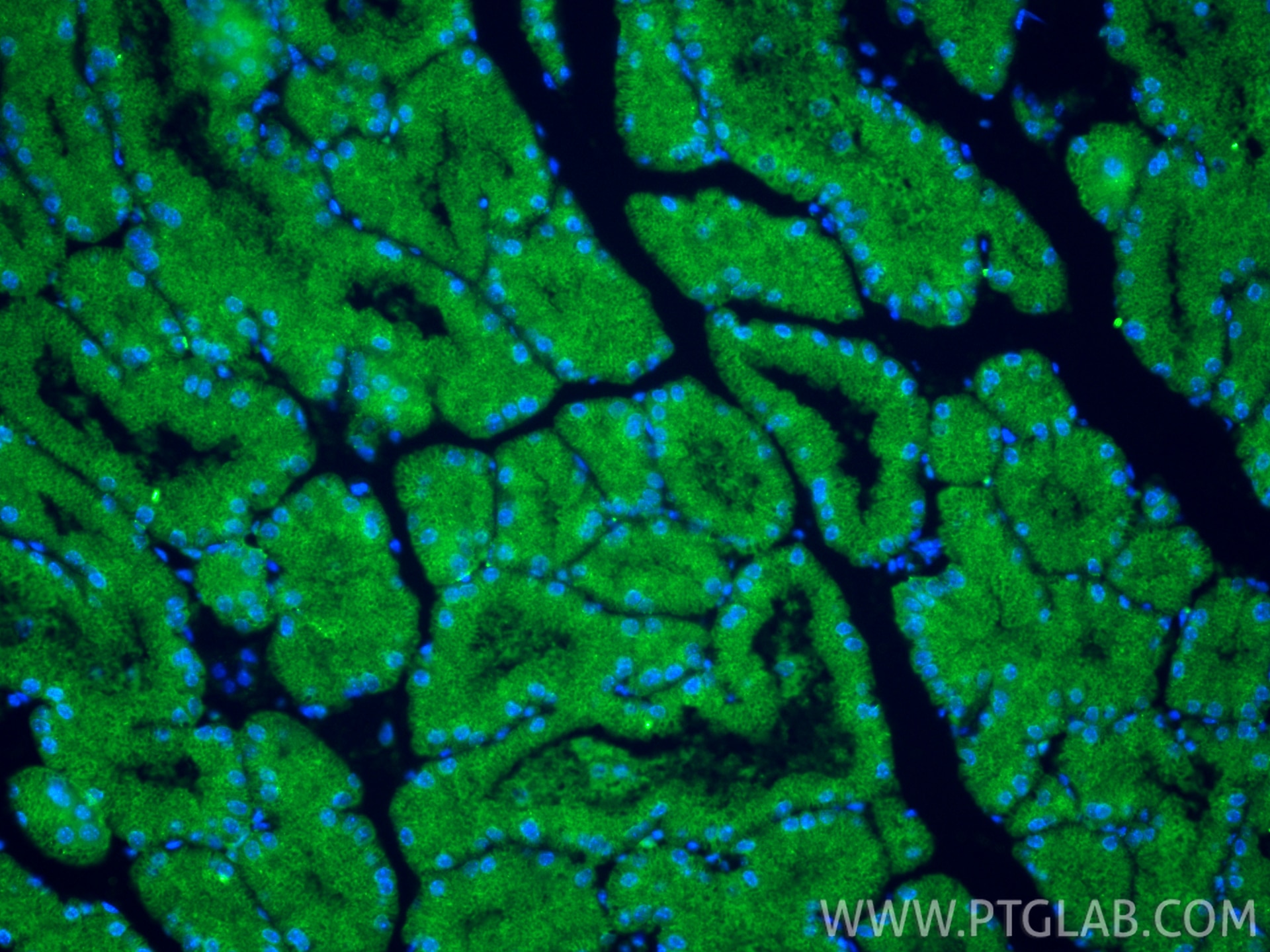 Immunofluorescent analysis of (4% PFA) fixed paraffin-embedded mouse brown adipose tissue using PLEKHF2 antibody (25424-1-AP) at dilution of 1:400 and CoraLite®488-Conjugated Goat Anti-Rabbit IgG(H+L) (SA00013-2). Heat mediated antigen retrieval with Tris-EDTA buffer (pH 9.0). Immunofluorescence (IF) / fluorescent staining of mouse brown adipose tissue using PLEKHF2 Polyclonal antibody (25424-1-AP)