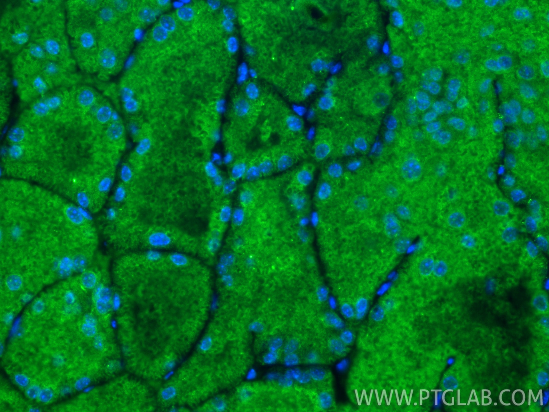 Immunofluorescent analysis of (4% PFA) fixed paraffin-embedded mouse brown adipose tissue using PLEKHF2 antibody (25424-1-AP) at dilution of 1:400 and CoraLite®488-Conjugated Goat Anti-Rabbit IgG(H+L) (SA00013-2). Heat mediated antigen retrieval with Tris-EDTA buffer (pH 9.0). Immunofluorescence (IF) / fluorescent staining of mouse brown adipose tissue using PLEKHF2 Polyclonal antibody (25424-1-AP)