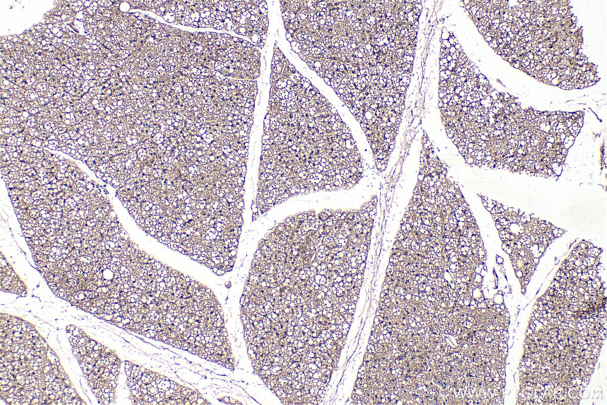 Immunohistochemical analysis of paraffin-embedded mouse brown adipose tissue slide using 25424-1-AP (PLEKHF2 antibody) at dilution of 1:300 (under 10x lens). Heat mediated antigen retrieval with Tris-EDTA buffer (pH 9.0). Immunohistochemistry (IHC) staining of mouse brown adipose tissue using PLEKHF2 Polyclonal antibody (25424-1-AP)