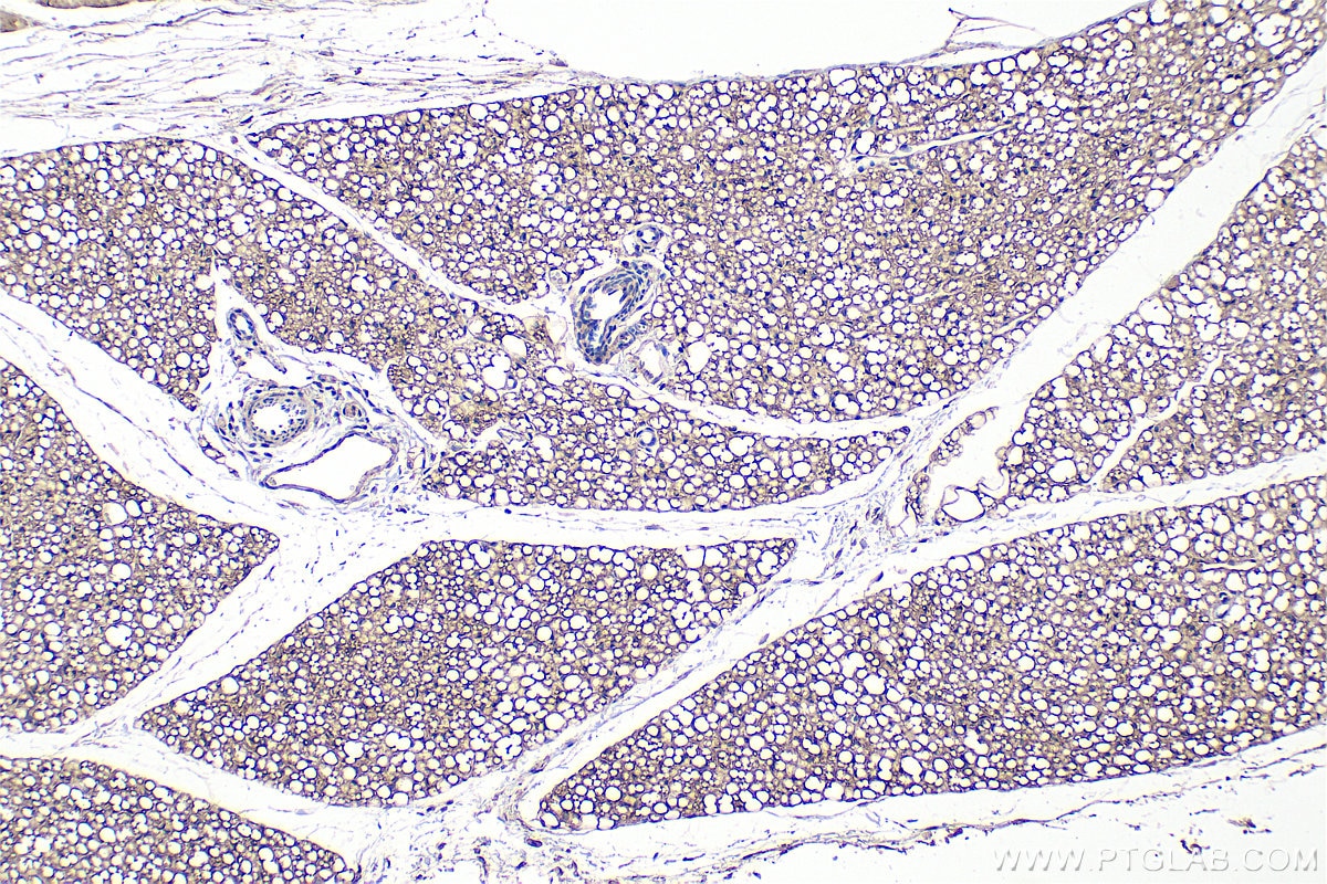 Immunohistochemical analysis of paraffin-embedded rat brown adipose tissue slide using 25424-1-AP (PLEKHF2 antibody) at dilution of 1:300 (under 10x lens). Heat mediated antigen retrieval with Tris-EDTA buffer (pH 9.0). Immunohistochemistry (IHC) staining of rat brown adipose tissue using PLEKHF2 Polyclonal antibody (25424-1-AP)