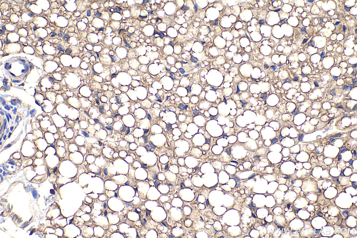 Immunohistochemical analysis of paraffin-embedded rat brown adipose tissue slide using 25424-1-AP (PLEKHF2 antibody) at dilution of 1:300 (under 40x lens). Heat mediated antigen retrieval with Tris-EDTA buffer (pH 9.0). Immunohistochemistry (IHC) staining of rat brown adipose tissue using PLEKHF2 Polyclonal antibody (25424-1-AP)