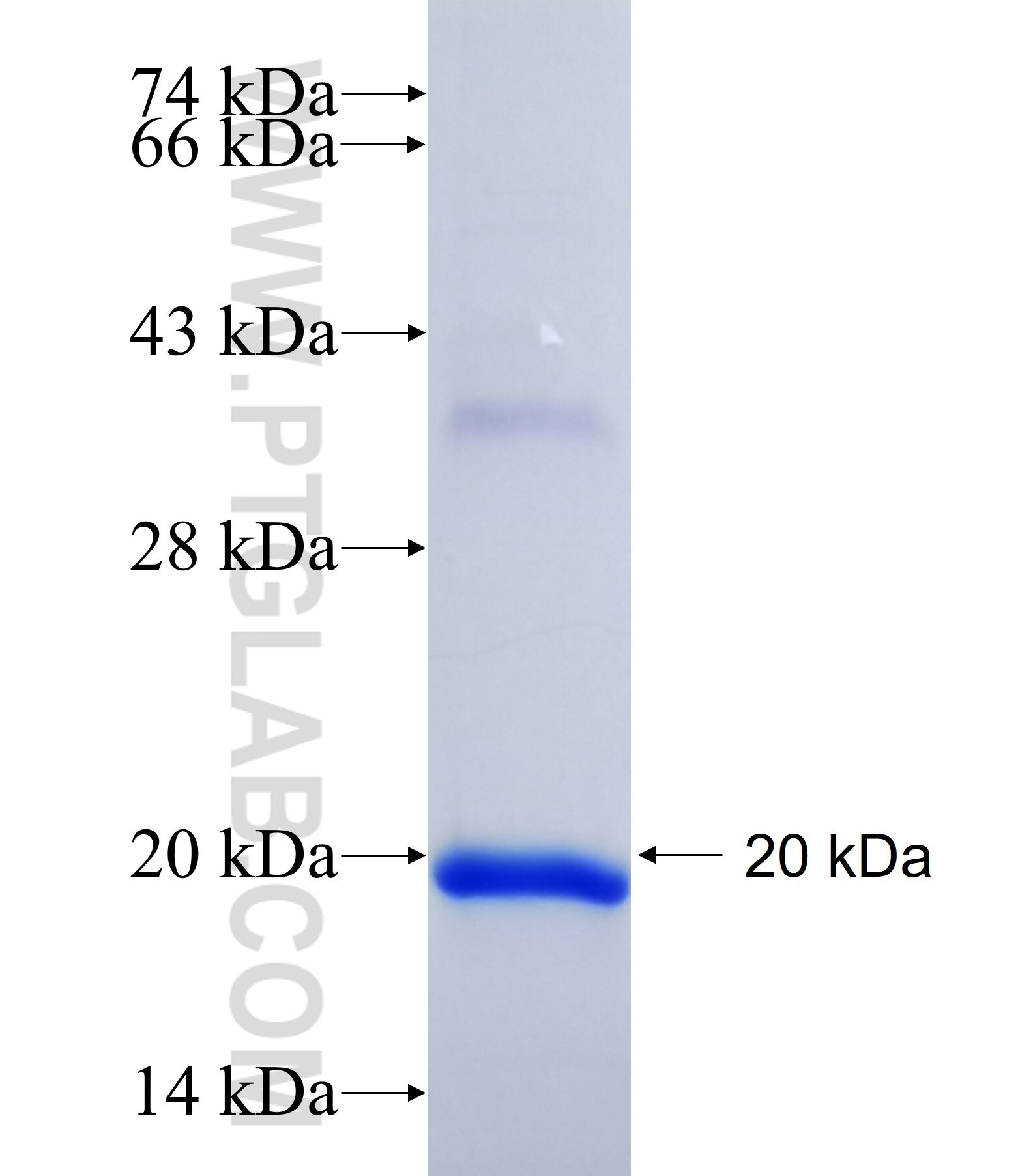 PLEKHG4B fusion protein Ag36704 SDS-PAGE