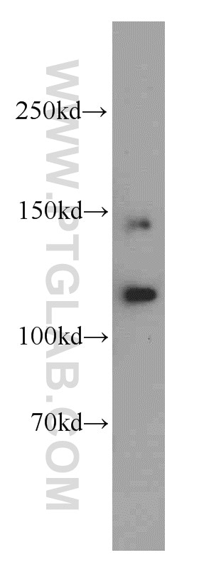 Western Blot (WB) analysis of mouse heart tissue using PLEKHG5 Polyclonal antibody (19830-1-AP)