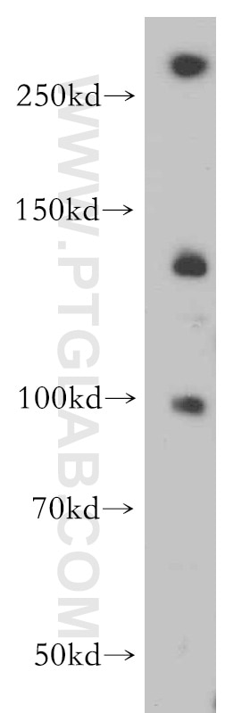 Western Blot (WB) analysis of A549 cells using PLEKHG5 Polyclonal antibody (19830-1-AP)