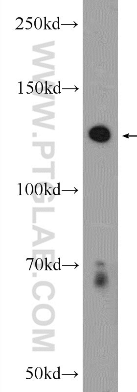 Western Blot (WB) analysis of Jurkat cells using PLEKHH2 Polyclonal antibody (14204-1-AP)