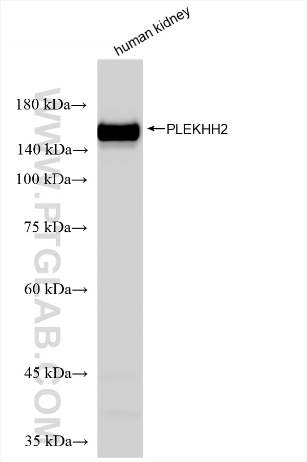 Western Blot (WB) analysis of human kidney tissue using PLEKHH2 Recombinant antibody (86166-3-RR)