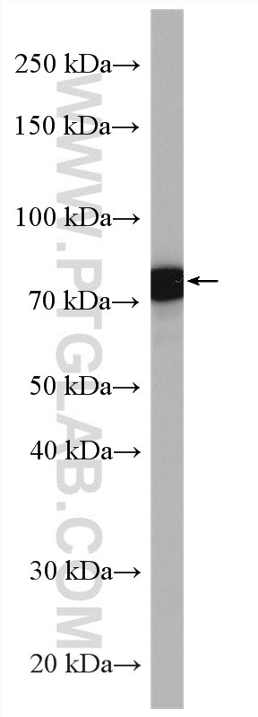 Western Blot (WB) analysis of mouse brain tissue using PLEKHH3 Polyclonal antibody (28154-1-AP)