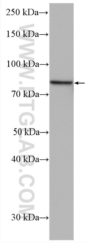 Western Blot (WB) analysis of LNCaP cells using PLEKHH3 Polyclonal antibody (28154-1-AP)