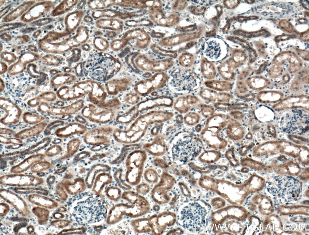 Immunohistochemistry (IHC) staining of human kidney tissue using PLEKHM1 Polyclonal antibody (16202-1-AP)