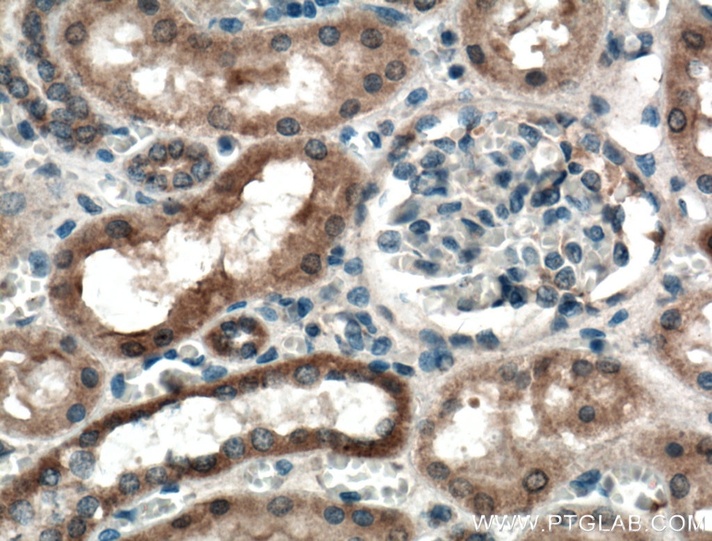 Immunohistochemistry (IHC) staining of human kidney tissue using PLEKHM1 Polyclonal antibody (16202-1-AP)
