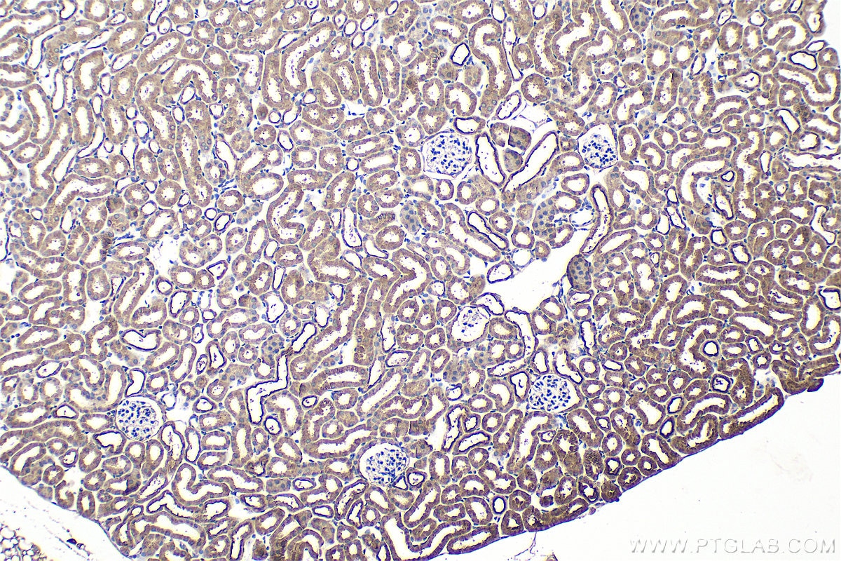 Immunohistochemistry (IHC) staining of mouse kidney tissue using PLEKHM1 Polyclonal antibody (16202-1-AP)