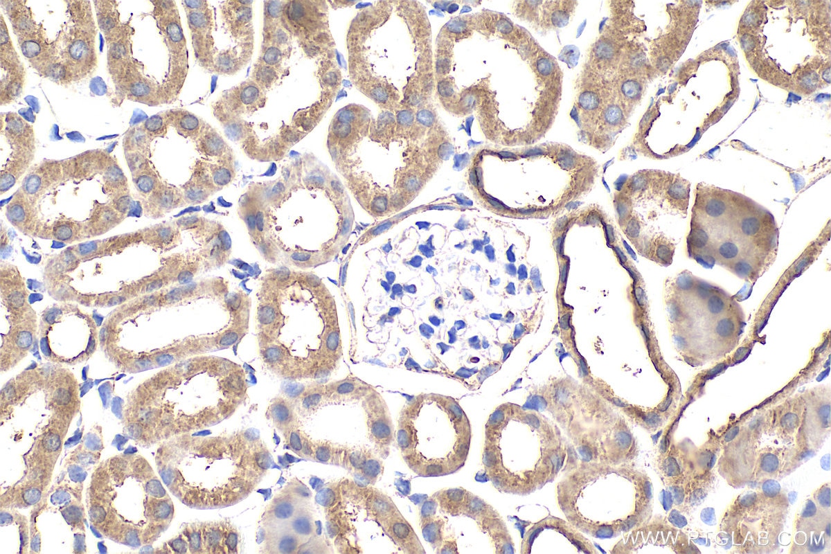 Immunohistochemistry (IHC) staining of mouse kidney tissue using PLEKHM1 Polyclonal antibody (16202-1-AP)