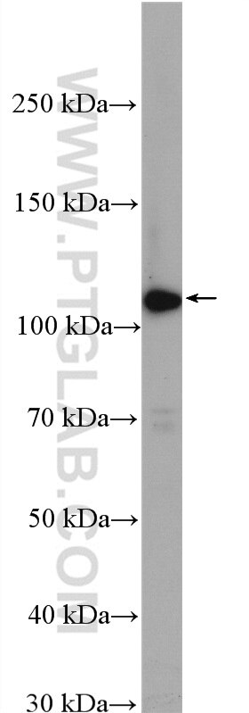 Western Blot (WB) analysis of ROS1728 cells using PLEKHM1 Polyclonal antibody (16202-1-AP)